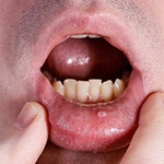 A man with a suspicious lesion