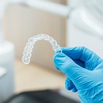 Dentist with blue gloves holding clear aligner