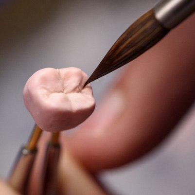 closeup of dentist polishing crown 