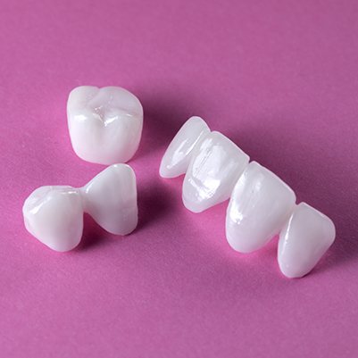 Metal-free dental restoration options