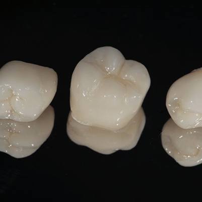 three dental crowns in Frisco on black background