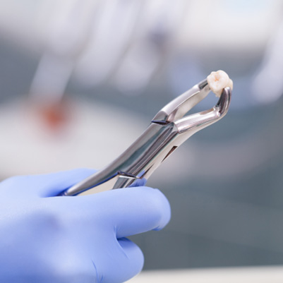 Extracted tooth held by forceps