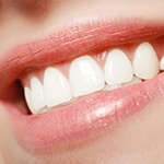 Woman’s healthy, beautiful smile after scaling and root planing treatment