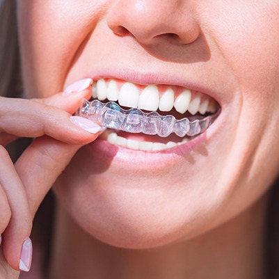 Smiling woman putting on clear aligner
