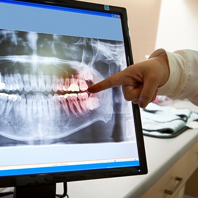 Digital dental x-rays