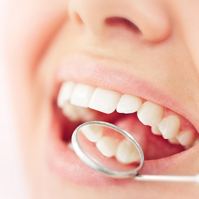 Dental mirror showing patient's white, healthy teeth