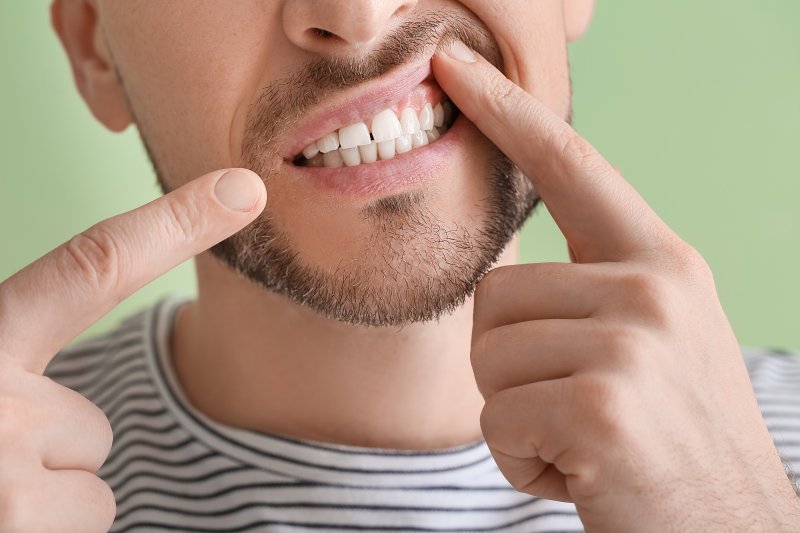 Close-up of dental patient's gums