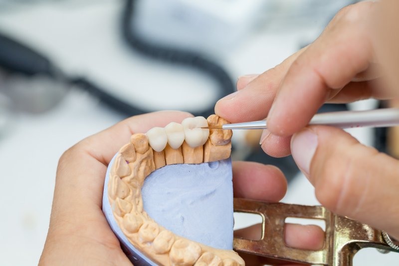 A technician using stains to color-match some dental crowns