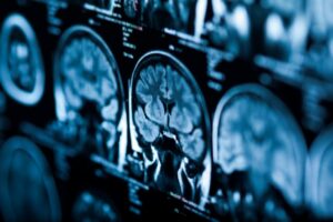 image of brain scans
